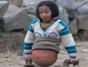 История невероятно сильной девочки без ног. У ее родителей не было денег на протезы…