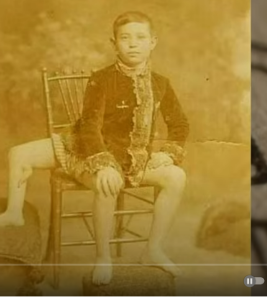 3 ноги и 2 мужских органа! Шокирующая история Фрэнка Лентини  Видео