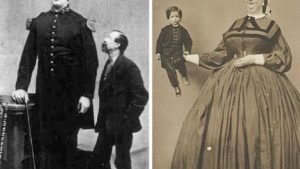 Реальные люди-мутанты, которые могли бы стать героями современных фильмов-ужасов