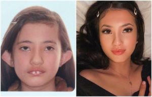 С возрастом, эти «гадкие утята» настолько изменились, что их теперь не узнать