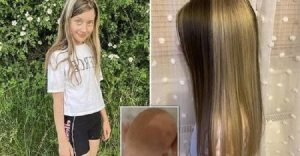 Одновременно шатенка и блондинка: девочка родилась с волосами двух цветов