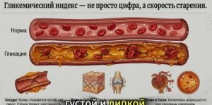 Каша, которая чистит сосуды, и Каша, которая вызывает диабет после 60. Полный список!  Видео