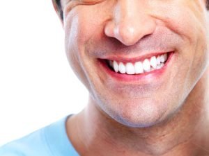 Плюсы и минусы отбеливания зубов