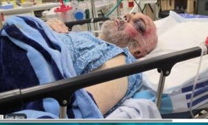 71-летнего Бориса из Ашдода жестоко избили и натравили на него собаку из-за замечания
