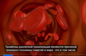 РАЗЖИЖАЕТ лучше аспирина /Скажите НЕТ ТРОМБАМ и ГУСТОЙ КРОВИ  Видео